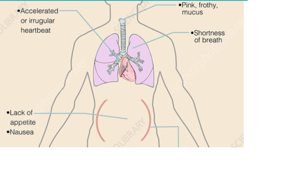 Heart disease, its causes, risk, and prevention learn in detail. 